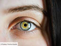 À ce propos, des études récentes ont montré que la couleur des yeux affectait pas loin de 16 gènes, ce qui complique considérablement sa prédiction. Changer La Couleur De Ses Yeux Grace A La Chirurgie Attention Danger Femme Actuelle Le Mag