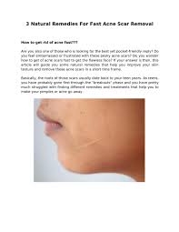 These remedies may not give. Ppt 3 Natural Remedies For Fast Acne Scar Removal Powerpoint Presentation Id 7497725