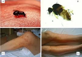 Image result for Erythrocephalum