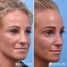 Meet Dr. Daniel Preston Ward of Form Derm Spa and Ward MD Facial Plastic  Surgery