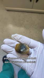 Sufres de dolor abdominal o ya tiene cálculos en su vesícula, pues si es  asi hágase operar a tiempo no espere complicarse #teampositivoloja  #cirujanoloja #calculosbiliares #cirugia #loja #ecuador