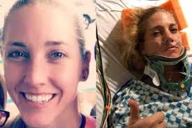 Fundraiser by Dominique Toscano : Ashlee Roger's Road to Recovery