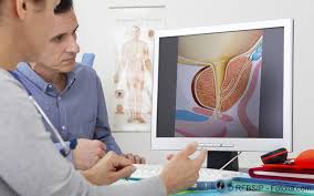 Prostatakrebs Symptome Diagnostik Therapie Gelbe Liste
