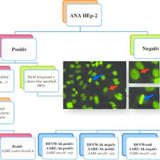 Pdf Dfs70 Antikorper Biomarker Zum Ausschluss Ana Assoziierter Rheumatischer Erkrankungen