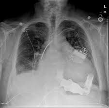 Pin On Excalibur Healthcare S Imaging Teleradiology Pins