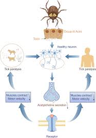 Image result for Tick Paralysis