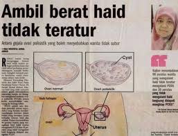 Tanda tanda melahirkan #3 frekuensi buang air kecil. 9 Tanda Sudah Menopaus Rahsia Cik Bunga