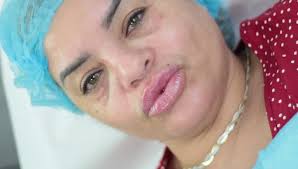 𝗘𝘀𝘁𝗲𝘁𝗶𝗰𝗮 𝗟𝘂𝘅𝘂𝗿𝘆 𝗦𝗸𝗶𝗻𝗰𝗮𝗿𝗲 𝗥𝗗💋 (@luxuryskincarerd) ·  Instagram 照片和视频