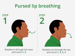 Image result for Exercise in COPD