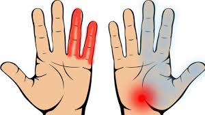 Sebenarnya kedutan mata kiri juga bisa menandakan kondisi tubuh. 7 Tanda Penyakit Yang Boleh Kita Kesan Awal Hanya Dari Sakit Nyilu Dan Kebas Di Tapak Tangan My Info Maya