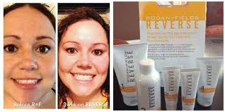 Dr. Oz calls Vitamin C “the secret to cheat your age”. Vitamin C is the key  to maintaining healthy, youthful skin. It's a super antioxidant that slows  the rate of free-radical damage,