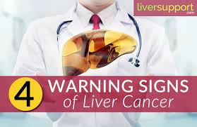 If you have one or more of the following symptoms, it is better to meet a physician and get yourself evaluated. 4 Liver Cancer Warning Signsyou Need To Watch Out For