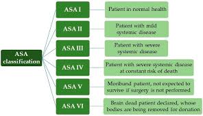 Image result for ASA Class