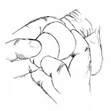 Image result for paraphimosis