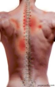 Pin On Sciatica Pain Relief