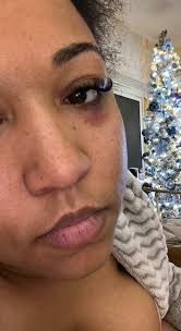 I was mowed down by a hit-and-run driver who left me and my puppy for dead