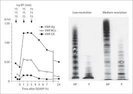 Technical difference is flow cell is placed in between lamp and optics but in uv it is placed after grating. No Response Of Vwf Cb Poor Response Of Vwf Rco And Good Response Of Download Scientific Diagram
