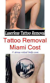Tattoo Printer Tattoo Removal Machine Suppliers Does Laser Tattoo Removal Work On All Colors Excision Tattoo Remov Tattoo Removal Cost Tattoos Tattoo Removal