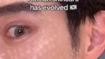 Innovative Korean Skincare: Reedle Shot 100 Review