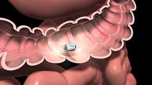 Image result for Virtual Endoscopy
