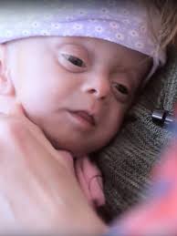 Ihr kind ist nicht lebensfähig. Beruhrende Geschichte Das Baby Ohne Gehirn Wunderweib