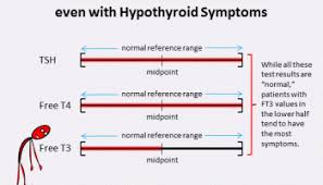 Levothyroxine Dosage