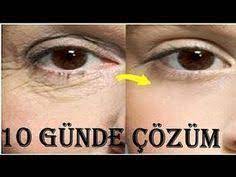 10 Gunde Goz Alti Kirisiklari Giderici Botoks Etkili Dogal Maske Tarifi Guzellik Bakim Youtube Maskeler Guzellik Gozler