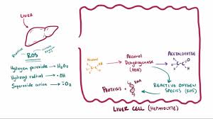 Alcoholic Liver Disease Hepatic And Biliary Disorders