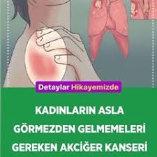 Akciger Kanseri Baslangic Belirtilerini Sizler Icin Ekledik Yazimizi Okumak Icin Profil Resmine Tiklayip Hikayemizden Goz Atabi Memes Ecard Meme Ecards