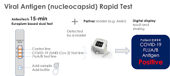Anteotech Creates Gigh Sensitivity 15 Minute Covid 19 Antigen Test To Support Rapid Clinical Decision Making Lab Manager