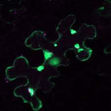 Check spelling or type a new query. Image Of The Day Pseudomonas Autophagy The Scientist Magazine