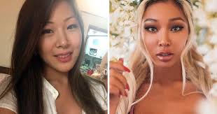 Did jessi the kpop star get surgery