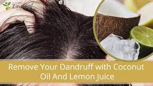 Apply this warm mixture of coconut oil and lemon juice to your scalp and hair. Remove Your Dandruff With Coconut Oil And Lemon Juice Youtube