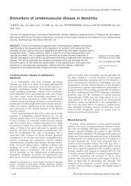 Home » 1931 » capturas de pantalla » carátula » cartel » fotografía » charlie chan: Pdf Biomarkers Of Cerebrovascular Disease In Dementia