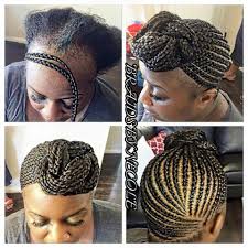 Edges are the baby hairs that grow along the hairline. 25 Thinning Edges Ideas Hair Styles Natural Hair Styles Alopecia Hairstyles