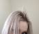 Severe Hair Breakage