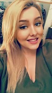 Young woman lives in danger of choking to death as her face swells to  DOUBLE its size