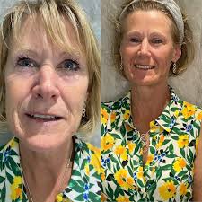 MDbeautytrainingaesthetics