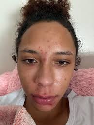 I need tips. I get so dizzy and nauseous whenever I change my jewelry. No  matter for what piercing. Does anyone have tips