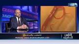 دكتور احمد حبيب
