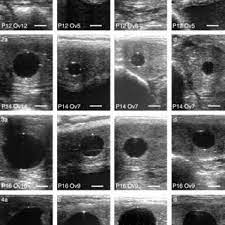 Embryonic Development Between Days 12 And 18 Of Gestation In A Download Scientific Diagram