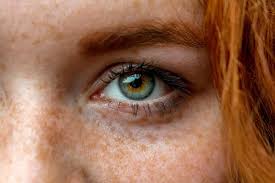 Image result for Freckled skin