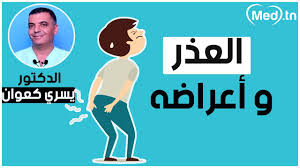 ظهور حبة في فتحة الشرج اهم الاعراض و طرق العلاج المجلة الطبية
