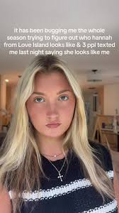 What Did Hannah Fields Do to Her Face