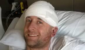 Comedian says man who attacked him with bat thinks he's Jesus