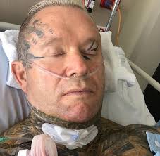 Lee priest has neck surgery 🙏