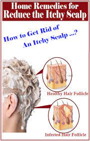 Itchy scalp is not only embarrassing but annoying. Pin On Natural Hair
