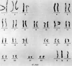 Males With Polysomy Y And Females With Polysomy X Glowm