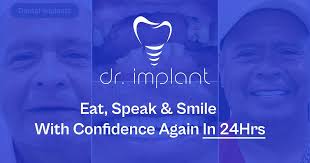 Dental Implant FAQ South Florida