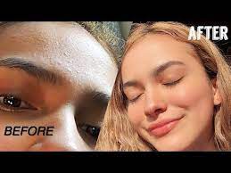 How I Got Rid Of Textured Skin My Skin Care Routine For Clear Skin Youtube In 2020 Clear Skin Routine Clear Skin Skin Routine
